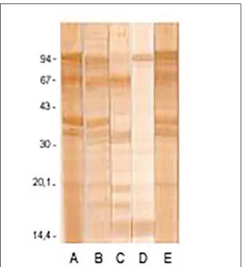 Figure 1   Western blotting reaction performed with enteropathoge- enteropathoge-nic E