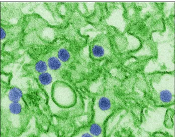 FIGURE 2   Electron micrograph transmission image digitally  colored shows Zika virus in blue