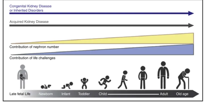 Figure 1 The types and risks of kidney disease change across the lifecycle. The contribution of nephron number increases over the life cycle, in concert with events that provide direct insults and challenges to kidney health.