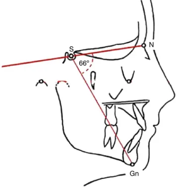 Figure 1 NS. Gn angle --- Y-growth axis.