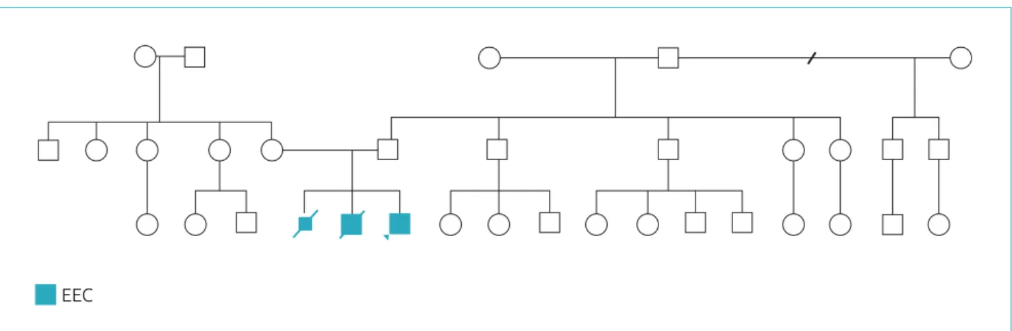 Figure 1 Pedigree of the family showing the individuals afected by EEC syndrome, indicative of germline mosaicism.