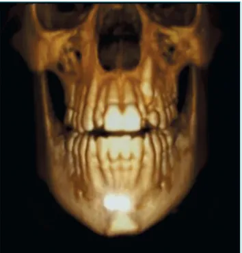 Figure 2 Frontal three-dimensional image.
