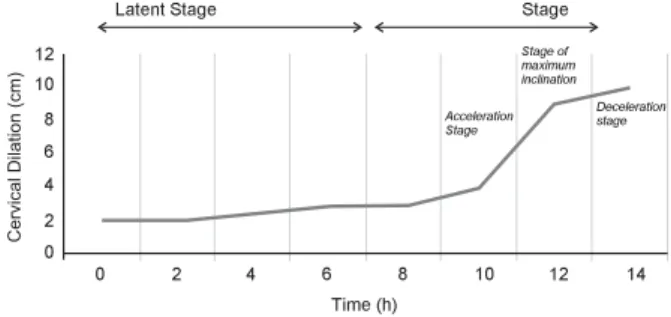 Figure 1 - Sigmoid curve of cervix dilation (cm) of the latent and active stages and the preparatory divisions of pelvic dilation in labor