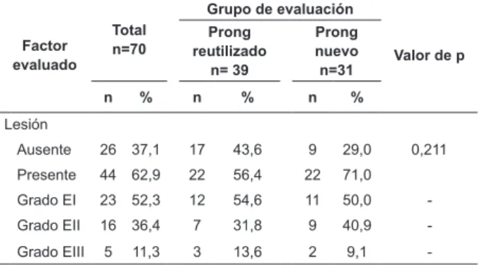 Tabla 1 - Incidencia y grado de lesión de tabique nasal en  neonatos sometidos a la ventilación con uso de prongs,  Recife, PE, Brasil, 2012