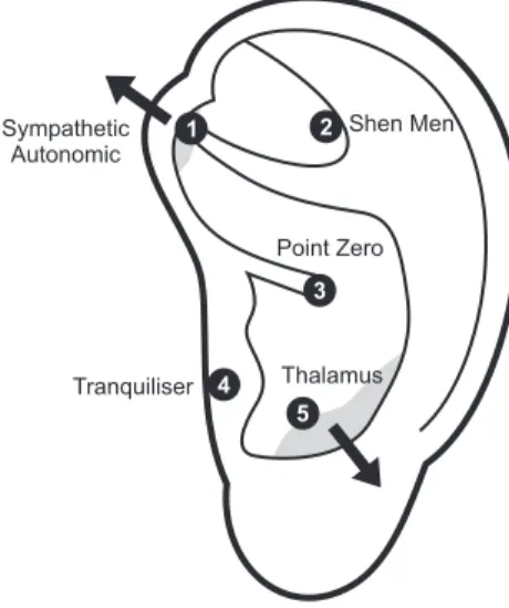 Figura 2 - Auricular Protocol for Pain &amp; Anxiety – APPA