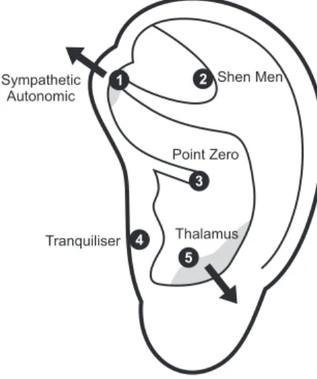 Figure 2 - Auricular Protocol for Pain &amp; Anxiety - APPA