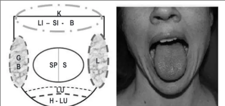 Figure 1 – Scheme of affected tongue zones – Liver (L), Gall Blad- Blad-der (GB) and Heart (H).