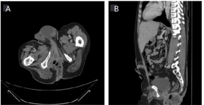 Figure 1 – CT of abdomen and pelvis. 