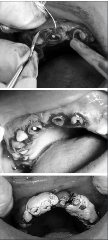 Figure 4. Radiographic control six month after