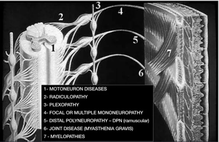 Figure 1 is a summary of the electrodiagnostic study process.