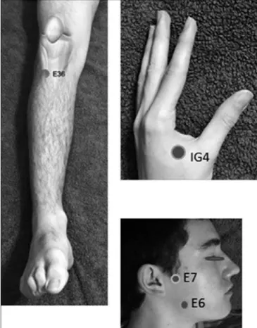 Figure 2. Most commonly used acupuncture points to treat temporo- temporo-mandibular dysfunction