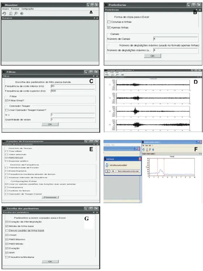 Figure 2 – 2A: Initial screen of EMG Bioanalyzer BR ; 2B: Preferences window of the EMG Bioanalyzer BR ;  2C: Window for the setting of parameters of the ilters to be used; 2D: Display window of raw records  of the four channels; 2E: Processing functions o