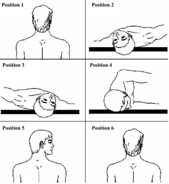 Figure 3 – Epley Manouver (Maia, Diniz and Carlese 16 ) problems)  and  four  for  “yes”  (presence  of  severe symptoms/dificulties)
