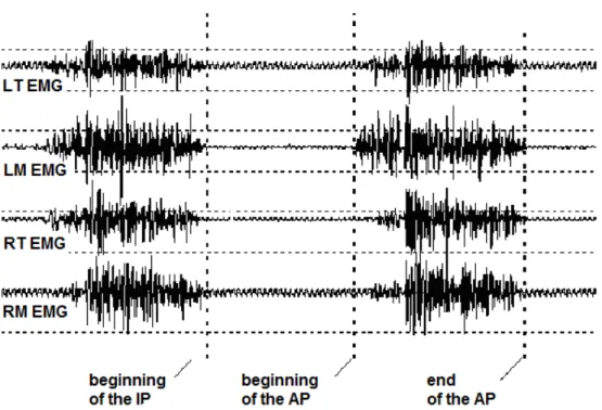 Figure 1 – EMG signal of Left Temporal (LT), Left Masseter (LM), Right Temporal (RT) and Right  Masseter (RM) muscles for a chewing cycle (Inactive Period (IP) and Active Period (AP).