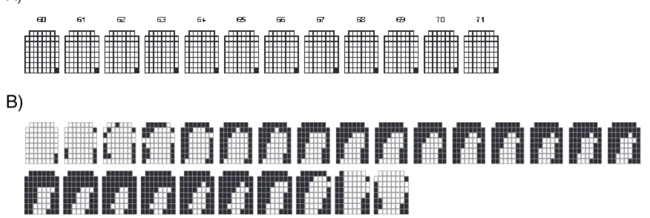 Figure 2 – Sequence of palatograms during the production of the phone [m], by the normal speaker  (A) and the speaker with cleft lip and palate (B)