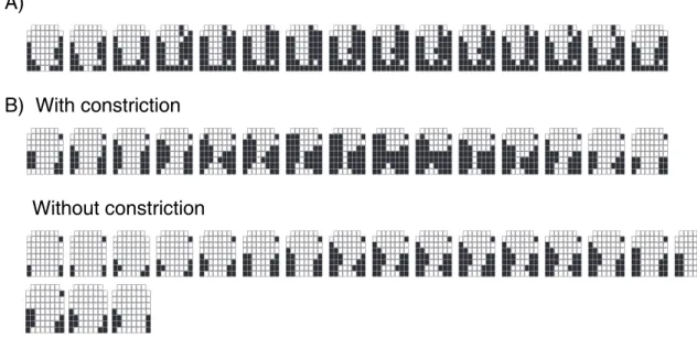 Figure 3 – Sequence of palatograms during the production of the phone [n], by the normal speaker  (A) and the speaker with cleft lip and palate (B)
