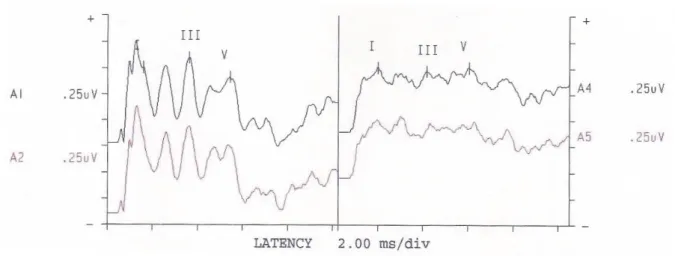 Figure 1 – Registration of ABR – Case 1