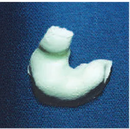 Figure 1 – Presentation of otoplastic ready for  scanning