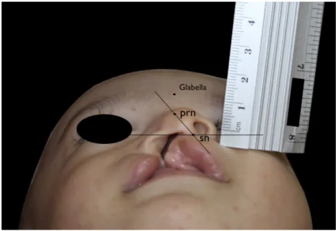 Figure 1 insertion place 