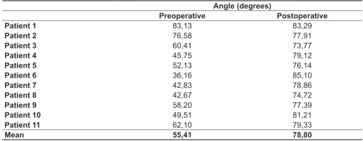 Table 3 – Patients distribution of pre and postoperative columellar angle means  Angle (degrees) Preoperative Postoperative Patient 1 83,13 83,29 Patient 2 76,58 77,91 Patient 3 60,41 73,77 Patient 4 45,75 79,12 Patient 5 52,13 76,14 Patient 6 36,16 85,10 