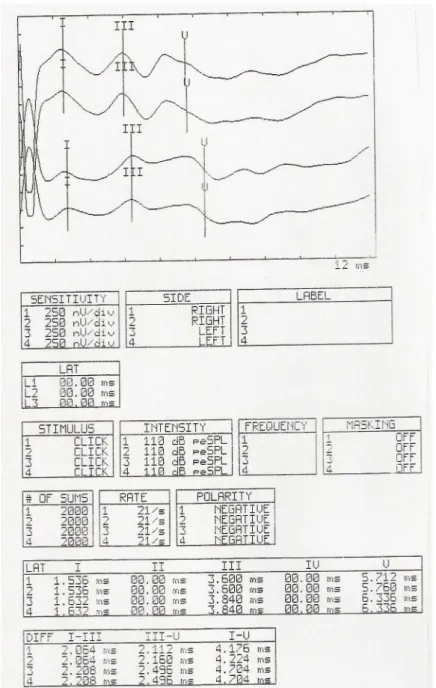 Figure 1 – Results PEATE (research of site of injury) in the pre-test 