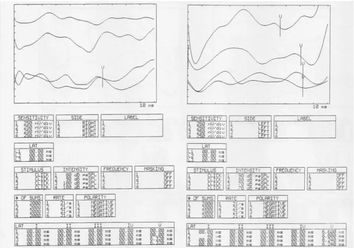 Figure 2 – Results PEATE (threshold  research) in the pre-test