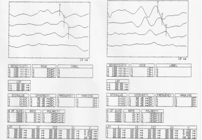 Figure 4 – Results PEATE (threshold  research) in the post-test