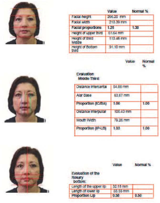 Figure 3B – Computerized cephalometry / front facial analysis