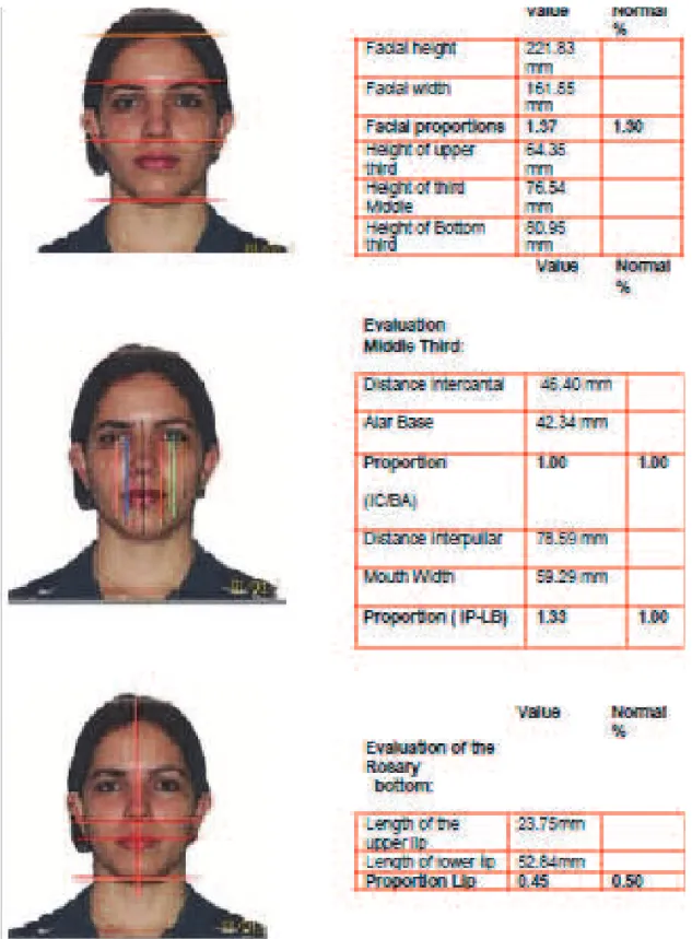 Figure 1B – Computerized cephalometry /frontal facial analysis
