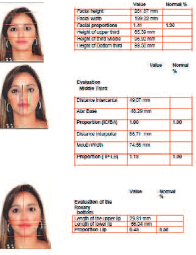 Figure 2A – Computerized cephalometry / front facial analysis