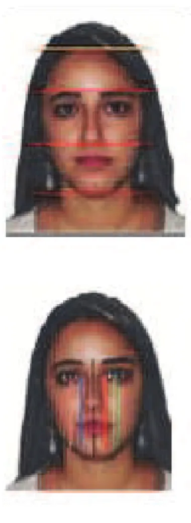 Figure 2B – Computerized cephalometry / front facial analysis