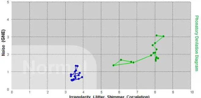 Figure 1 –  Area of normality in the phonatory deviation diagram, shown in a lighter shade of gray