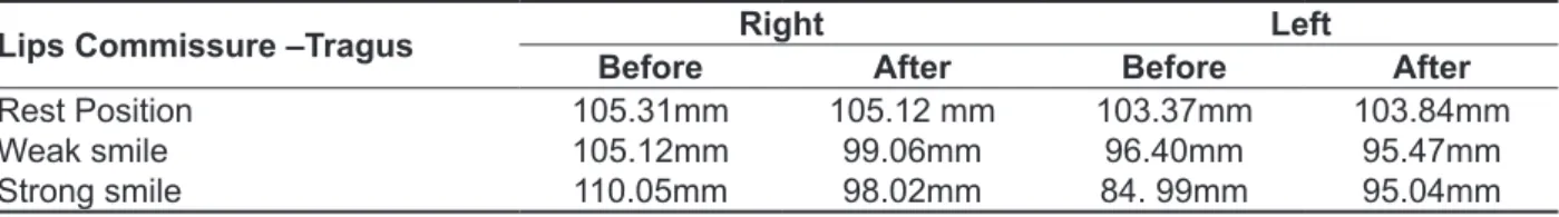 Table 3 – Facial measures obtained in the First and the Last Sessions. 