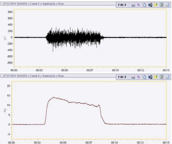 Figure 3.  Electromyographic signal registered simultaneously with the bite force.