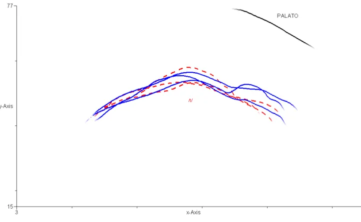 Figure 7.  Tongue curves traced on the midpoint of the stop /k/ - before and after therapy data