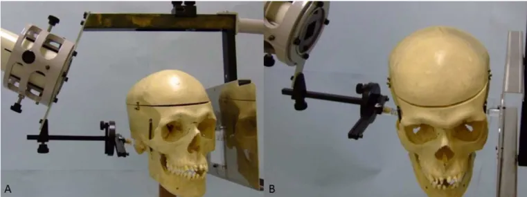 Figure 1.  Transcranial radiograph. (A, B) Stabilization of the dried human skull using the Accurad-200 head holder