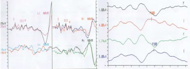 Figure 1. BEAP and P300 in evaluation 1