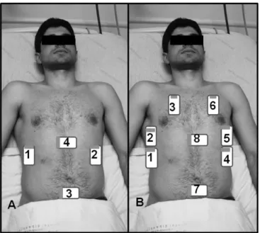 Figure  2-    FAST  (A)  and  EFAST  (B)  anatomical  refe- refe-rences. 