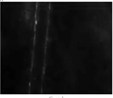 Figure 2 – Intravital microscopy images from experimental  animals studies from the Vascular Biology Clinical and  Experimental Research Laboratory of Universidade do  Estado do Rio de Janeiro