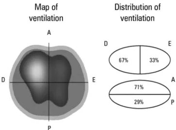 Figure 1 - Positioning of the electrodes for thoracic electrical impedance  tomography