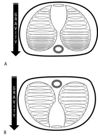 Figure 1 - A) Lungs in supine decubitus: Effect of superimposed pressures. 