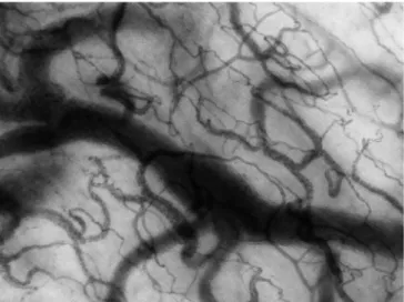 Figure 5 - Image of a vascular occlusion test monitored by near infrared  spectroscopy