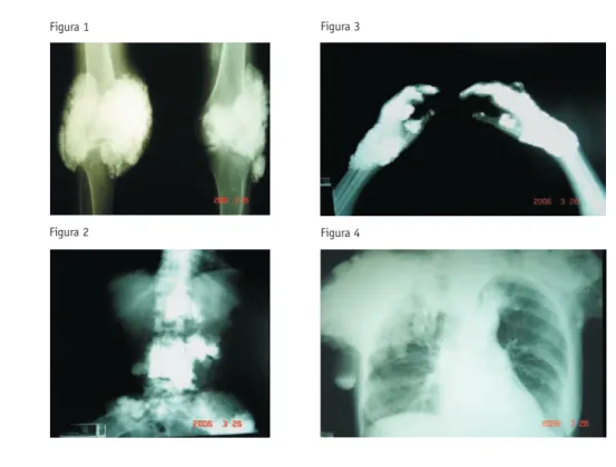 Figura 3: Radiografia de mãos e punhos; Figura 4: Radiografia de tórax.