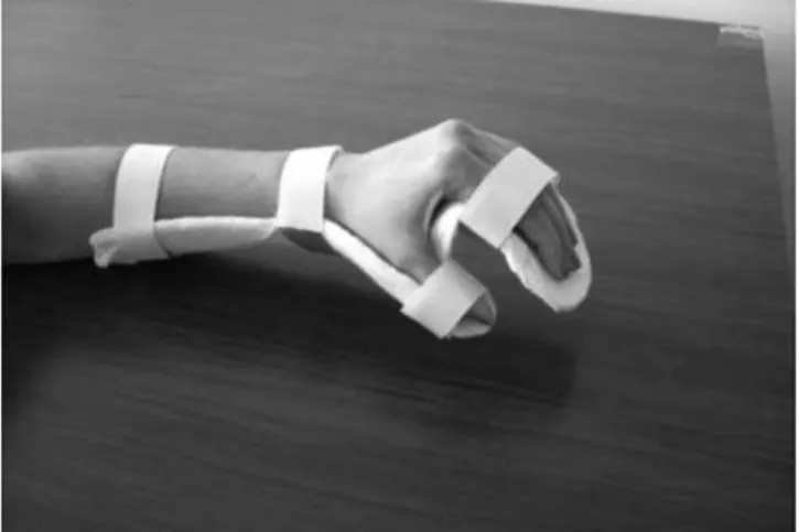 Figura 1 – Órtese de repouso ventral.