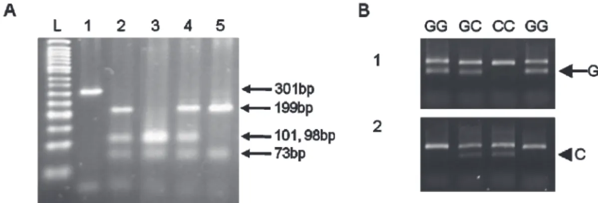 Fig. 1 – Genotyping for the IL-18 position -607 (a) and -137 (b) polymorphisms. (a) Genotyping SNP -607 C/A  locus  in IL-18  gene by PCR-RFLP technique, whose PCR products were followed by  Mse I (Biolabs, New England) digestion at 37°C for 12  hours, the