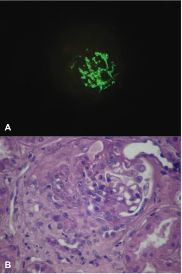 Fig. 1 – Renal biopsy  