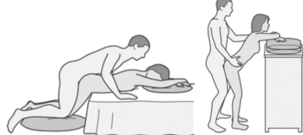 Fig. 3 – The patient has constraints to hip and knee mobility. In addition to the comfort provided by the reduced amplitude of movement, this position allows reducing the effort required for postural maintenance.