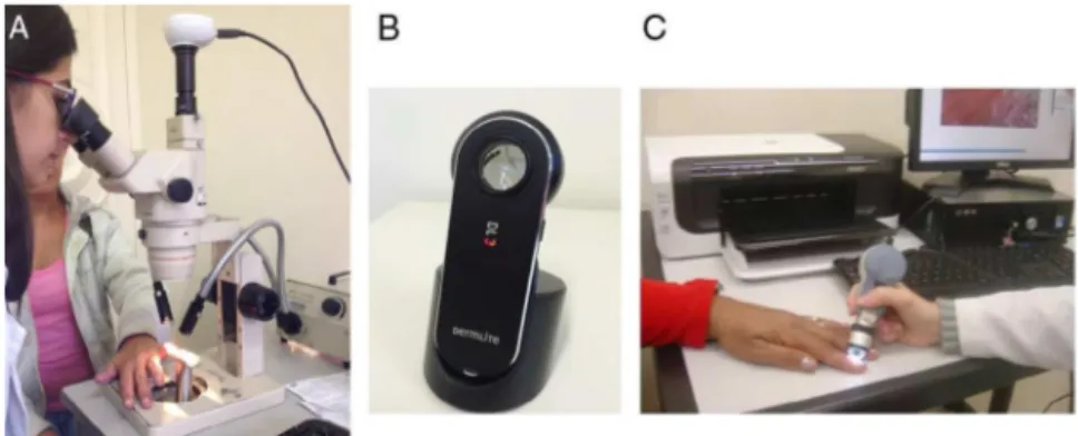 Fig. 1 – Devices that can be used for nailfold capillaroscopy: stereomicroscope (A); dermatoscope (B); videocapillaroscope (C).