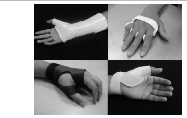 Fig. 3 – Examples of orthoses for upper limbs, suggested for patients with RA.