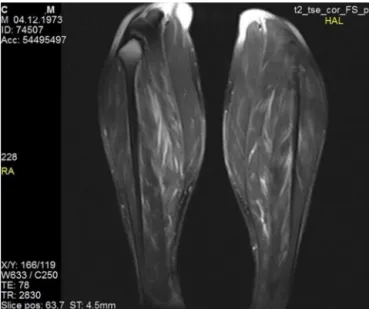 Fig. 1 – Both lower limbs’ MRI images of the patient.